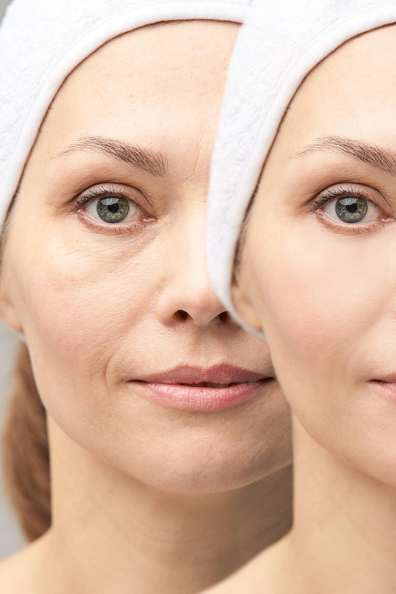 ¿Arrugas? Esta es tu rutina ideal de limpieza facial