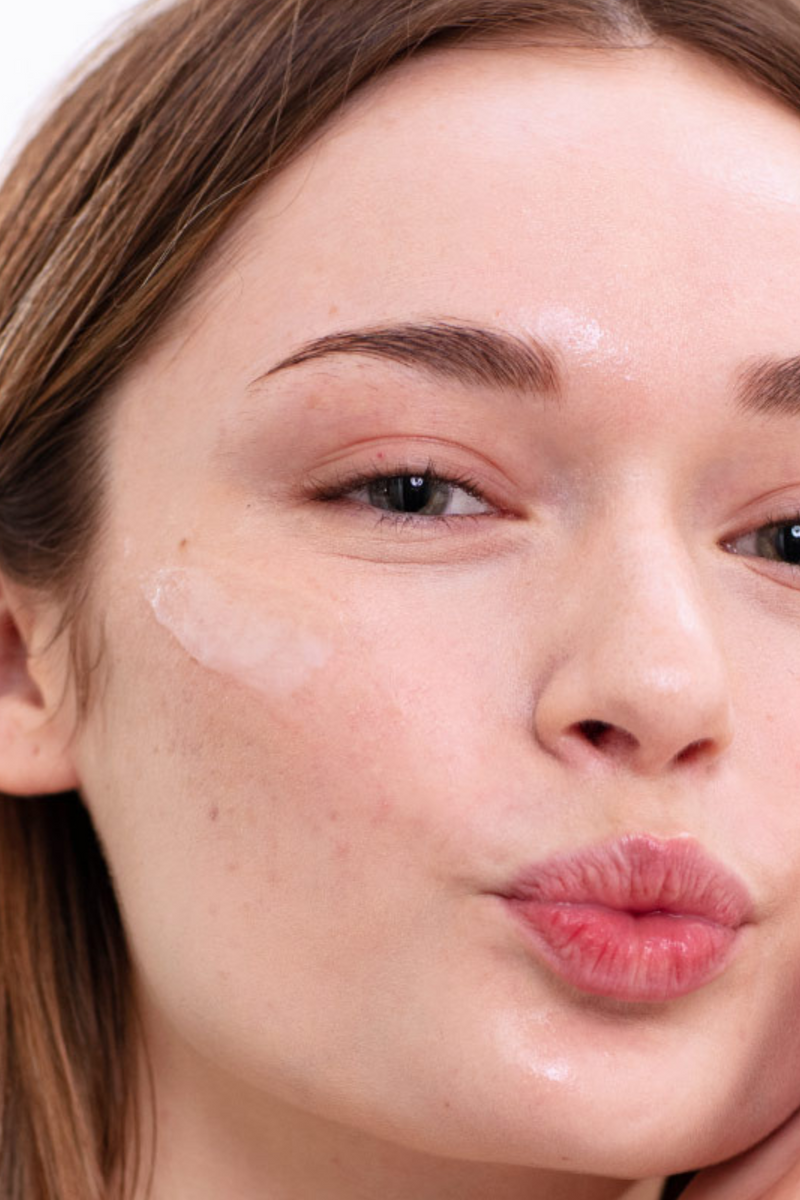 Todo lo que debes saber sobre el ácido azelaico