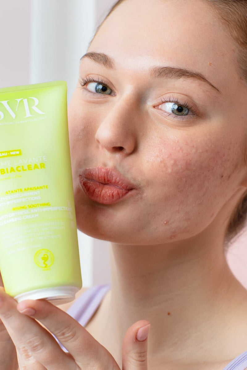 Acné hormonal: causas, síntomas y tratamientos eficaces