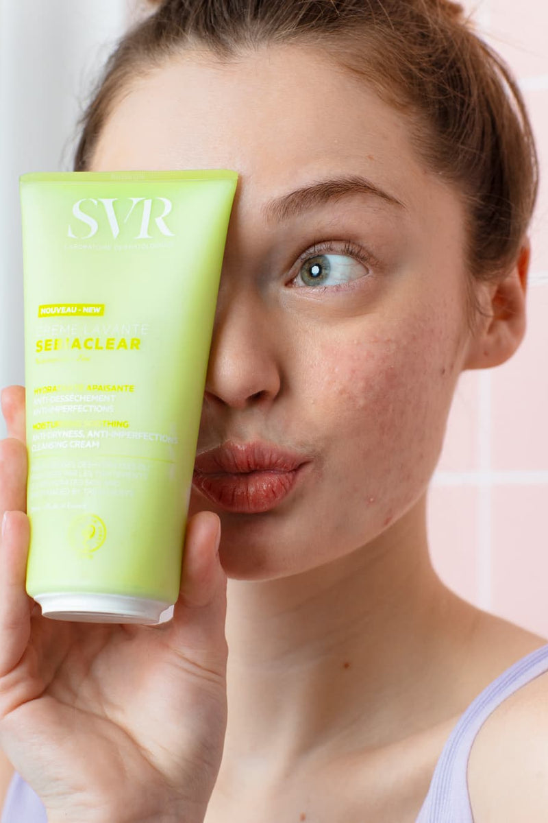 Acné juvenil: qué es, tipos y tratamientos