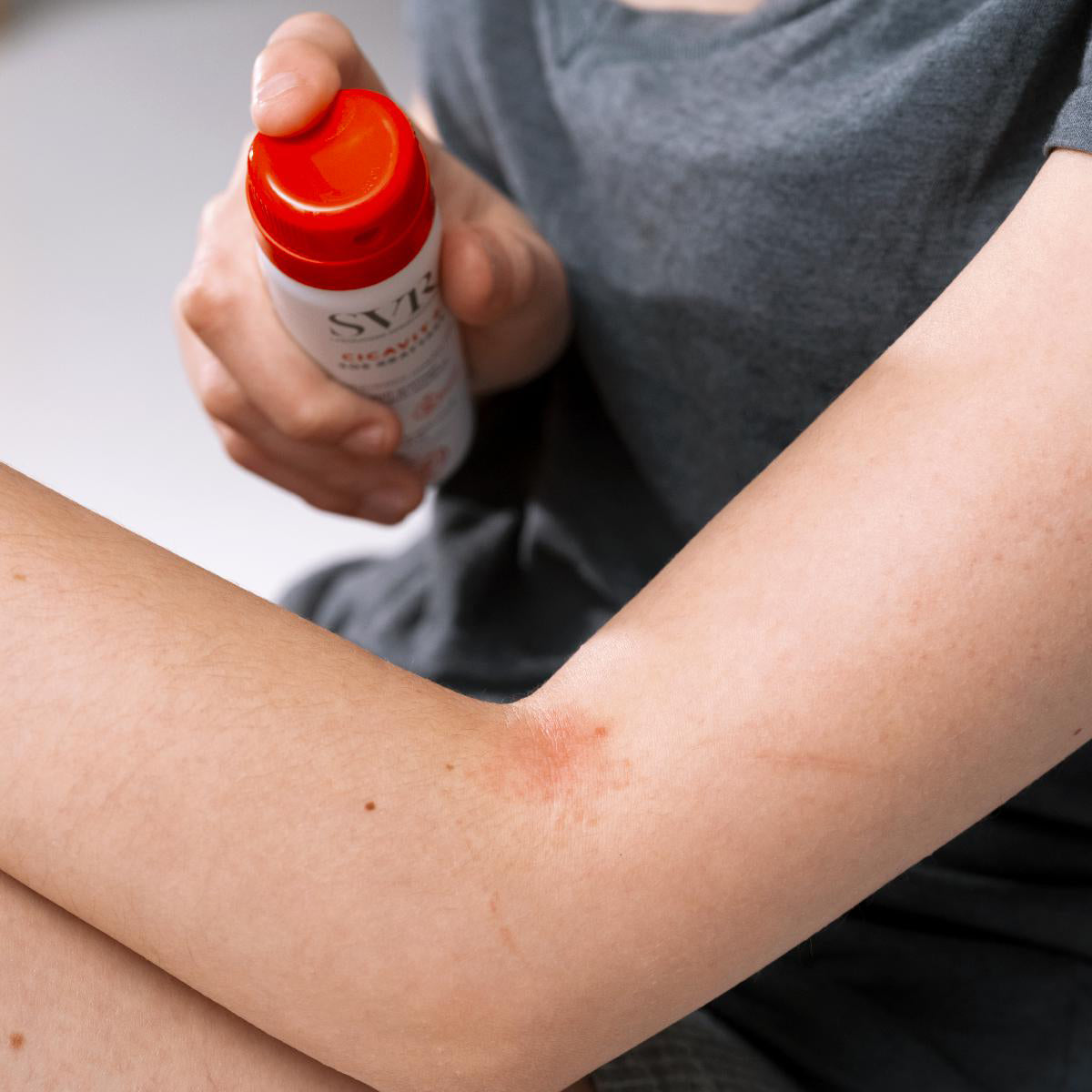 Spray calmante SVR Cicavit+ SOS Grattage aplicado sobre la piel irritada del brazo con tapón rojo distintivo.