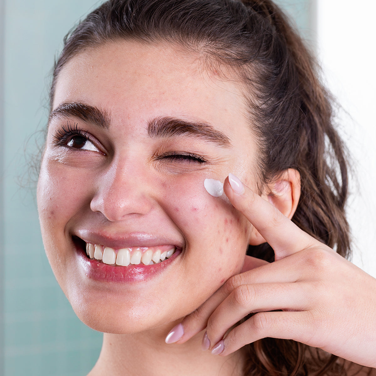 Mujer joven sonriendo mientras aplica crema reparadora blanca sobre una zona irritada de su mejilla.