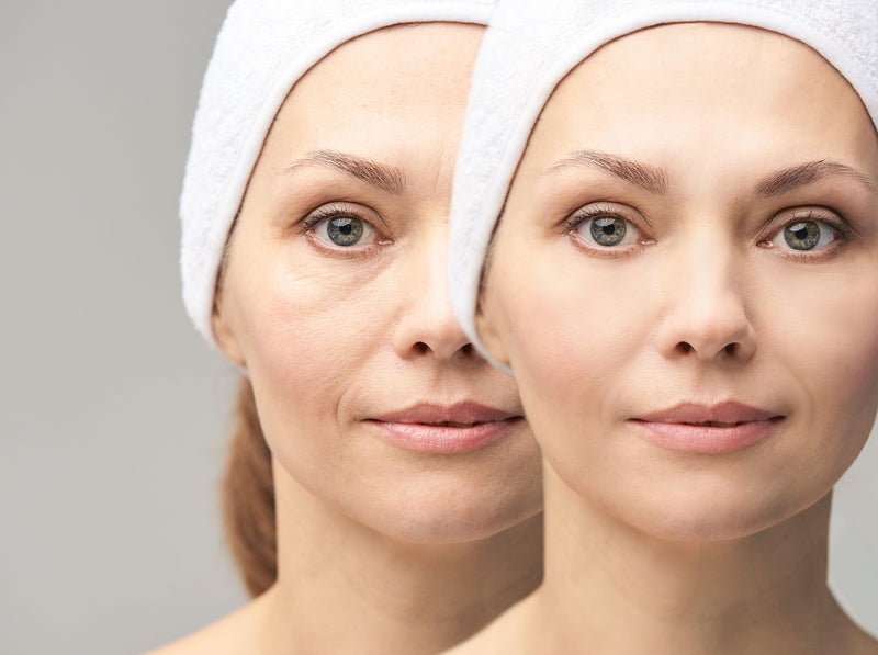 ¿Arrugas? Esta es tu rutina ideal de limpieza facial