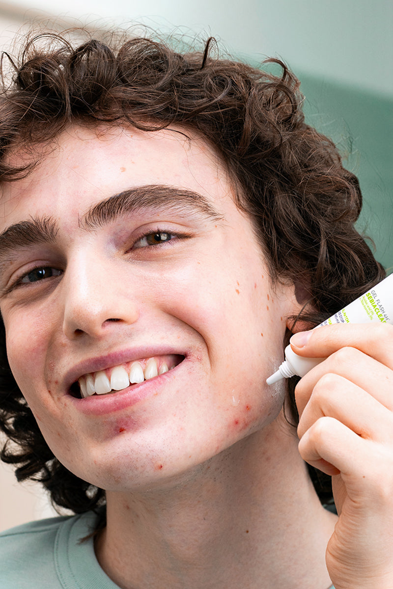 Adolescente aplicando un tratamiento contra el  acné - Gel Flash 4h SVR