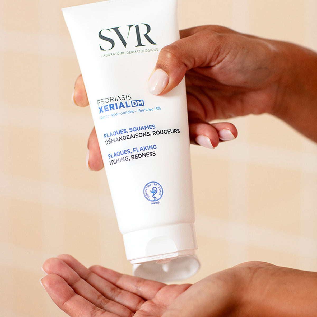 Tubo blanco de crema SVR Xerial DM para psoriasis siendo aplicado sobre la palma de una mano.
