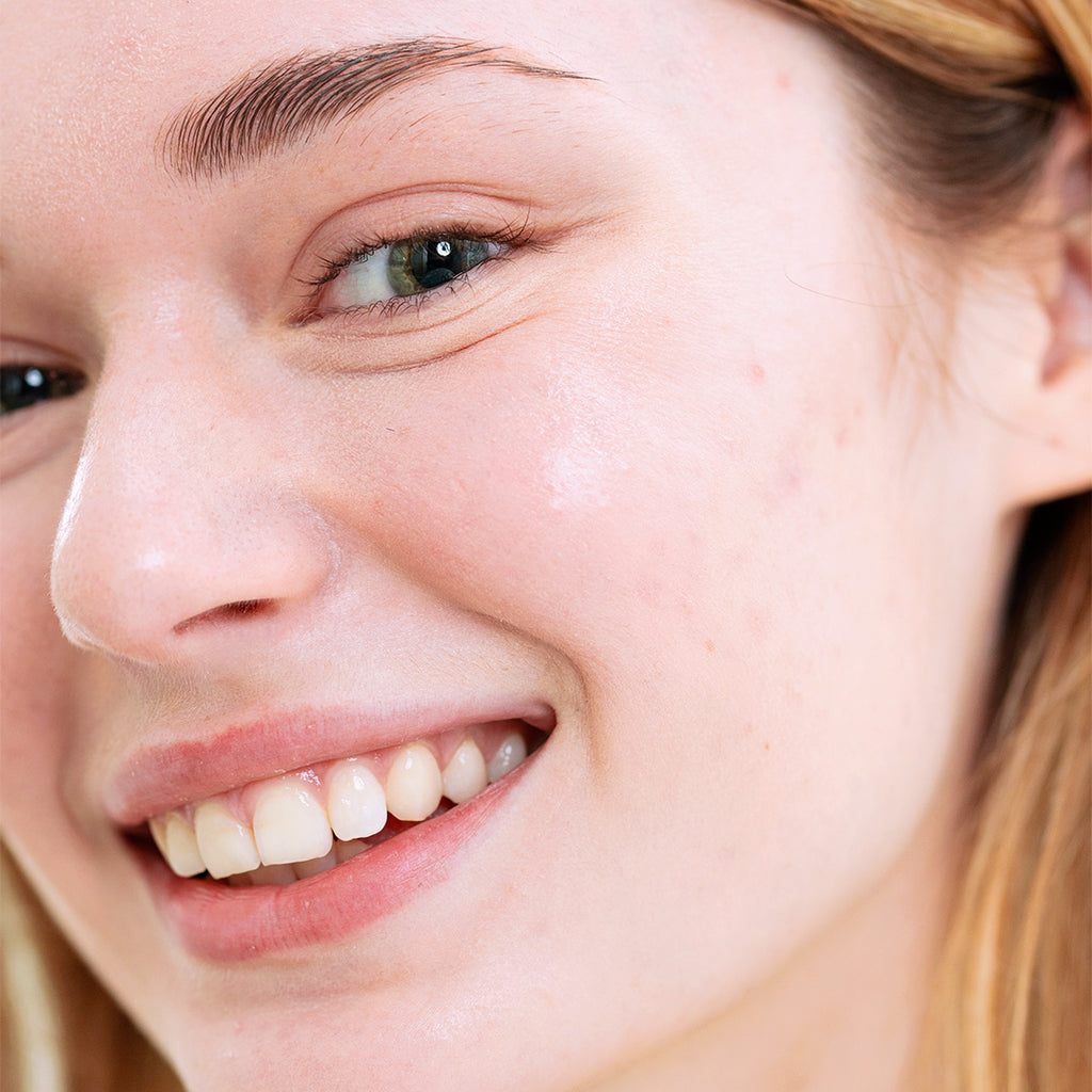 RUTINA ANTI IMPERFECCIONES