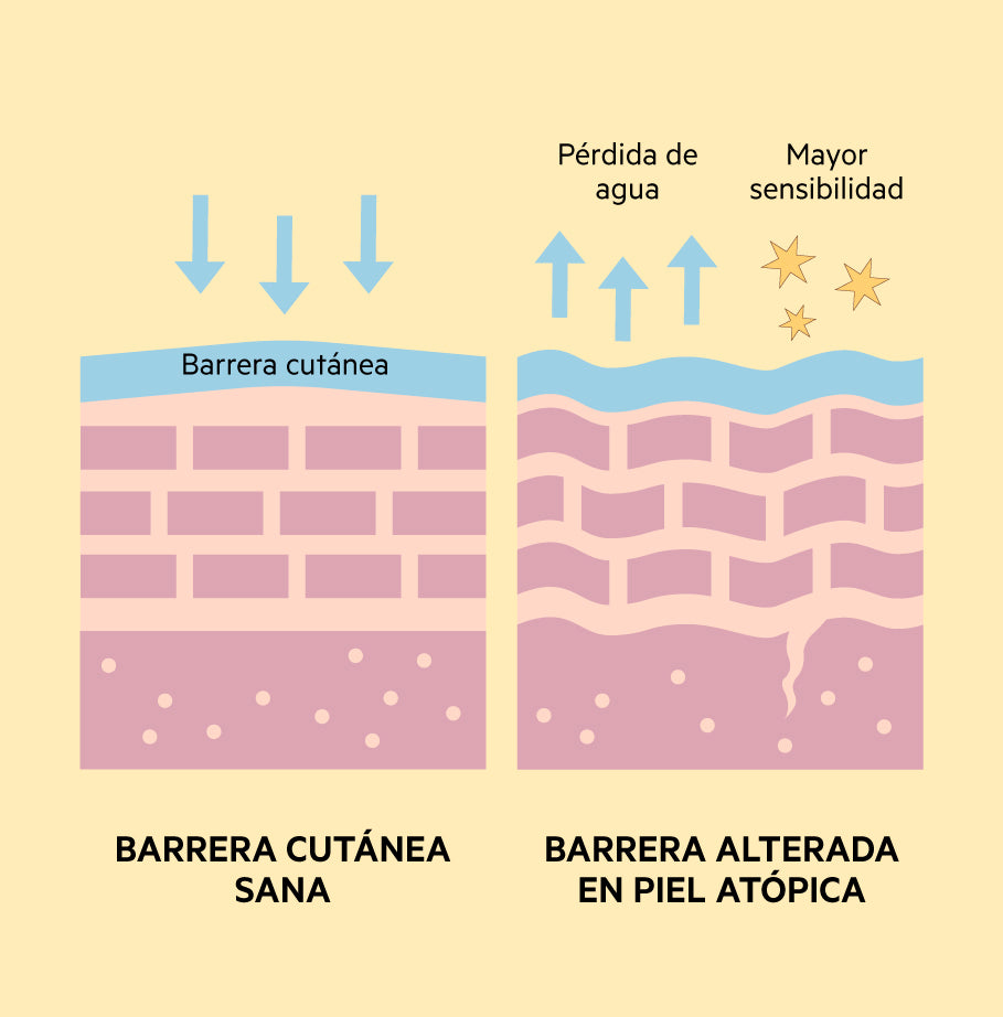 Ilustración comparativa de una barrera cutánea sana frente a una barrera alterada en piel atópica, con pérdida de agua y mayor sensibilidad.