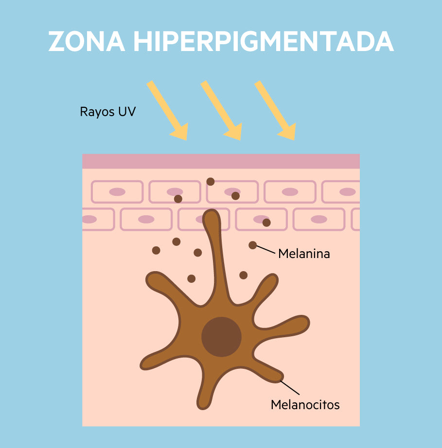 Proceso de melanogénesis: melanocitos produciendo melanina y generando la pigmentación de la piel